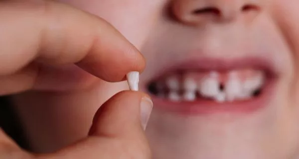 What are milk teeth and how are they formed?