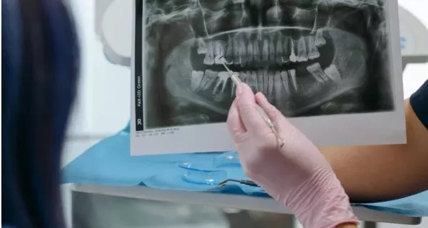 What dental X-rays do we offer in Ventura County?