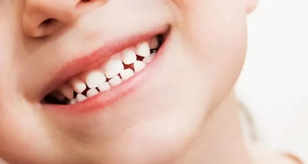 What is the difference between baby teeth and permanent teeth?