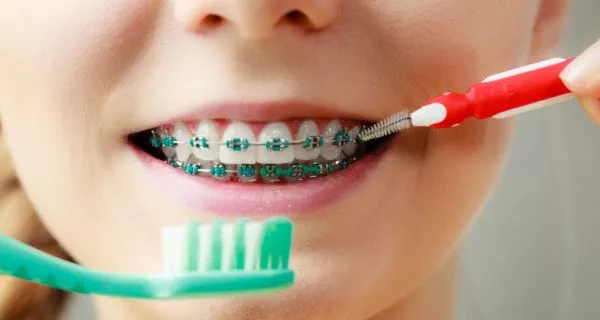 How do I brush every part of my teeth with braces?