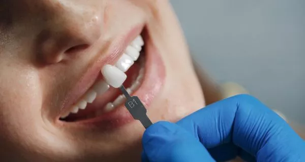 What are dental veneers and how can they improve my smile?