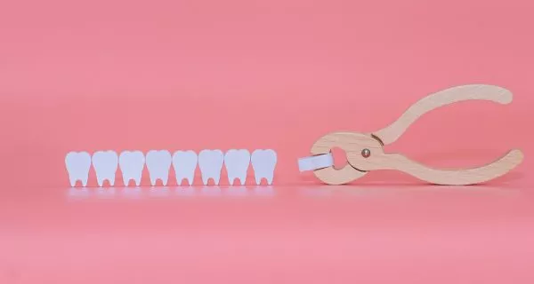 1. Exodoncias simples