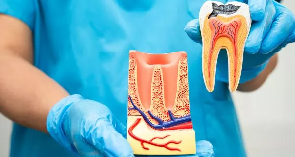 1. Root canal treatment or endodontics 