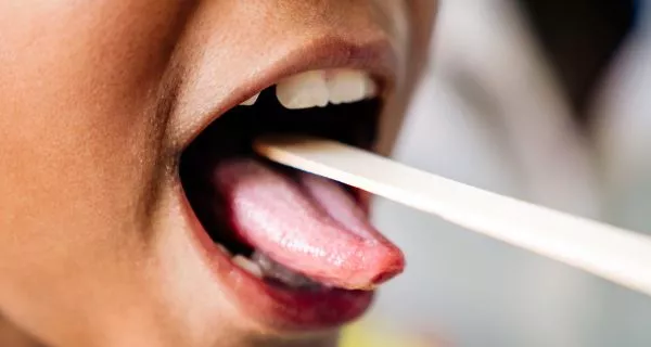 Causes of Burning Mouth Syndrome