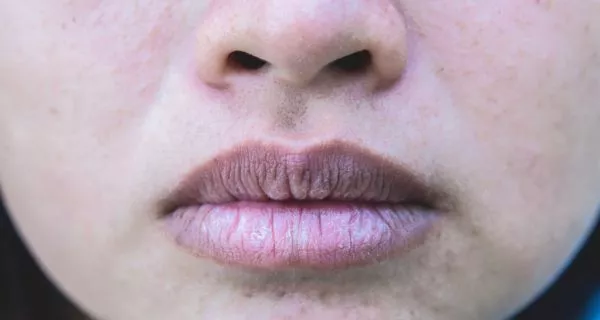 Could dry mouth be the reason?