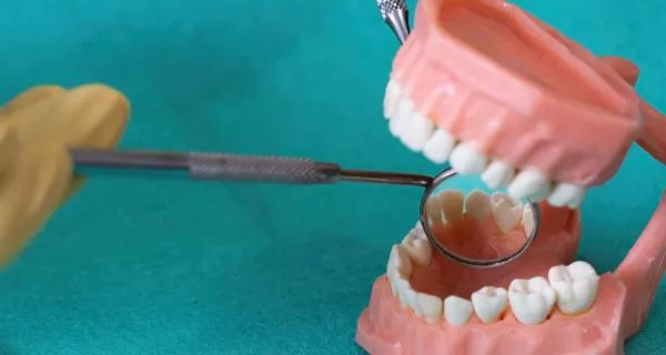 ¿Para qué sirve la carta dental (odontograma)?