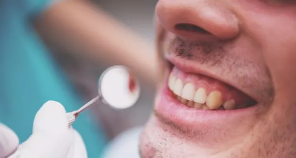 ¿Por qué el aguacate es bueno para tus dientes y encías?