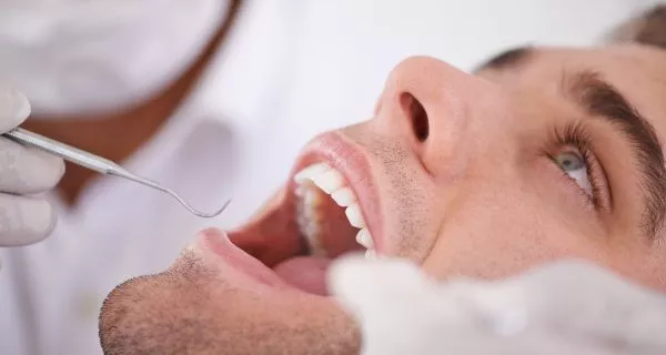 Prevención de las papilas gustativas hinchadas, Cuando acudir al dentista?