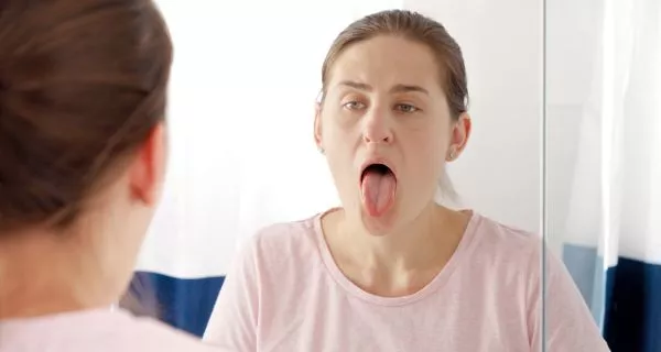 What are fungiform lingual papillae?