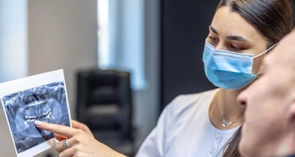 Why are dental x-rays important in a broken tooth emergency?