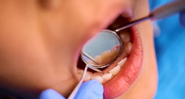 Why do dental abscesses occur?