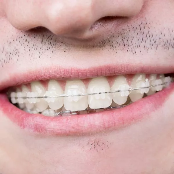 brackets transparentes - content6 - envatoimg