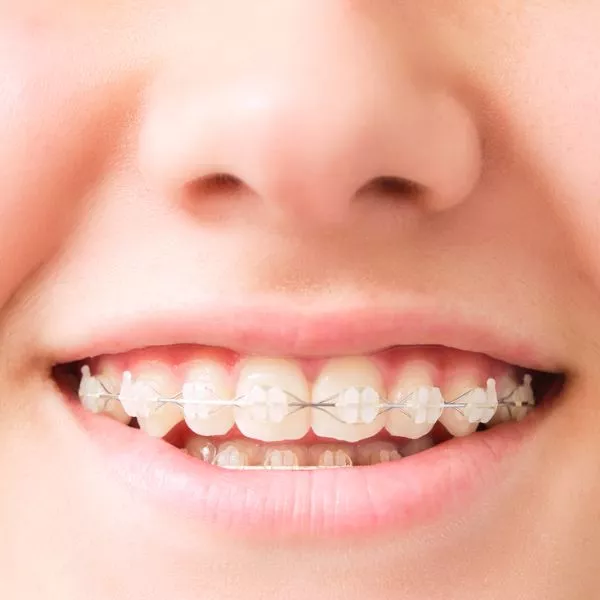 brackets transparentes - content7 - envatoimg