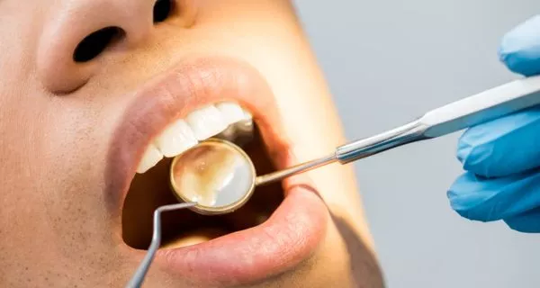 Caries and dental infection