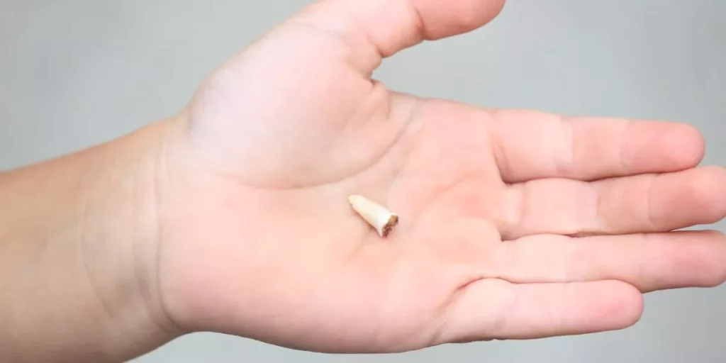 Diente roto o fracturado: qué hará tu dentista para salvarlo