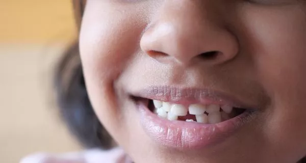 How long do baby teeth stay in the mouth?