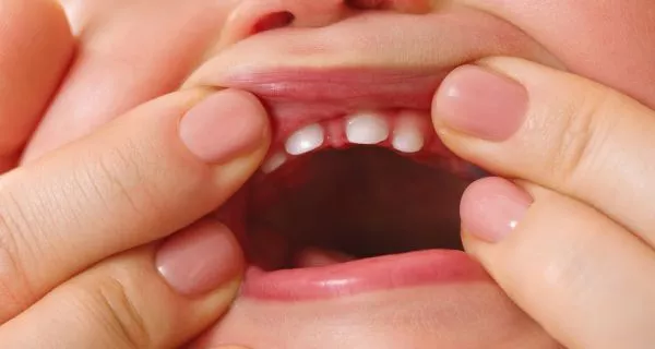 What are baby teeth and how do they form?