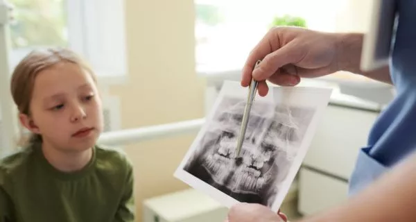 How is hyperdontia diagnosed?