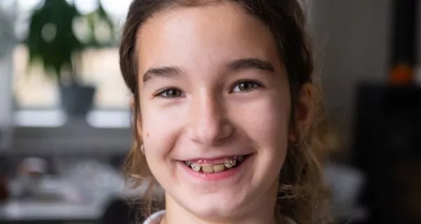 Orthodontic treatment